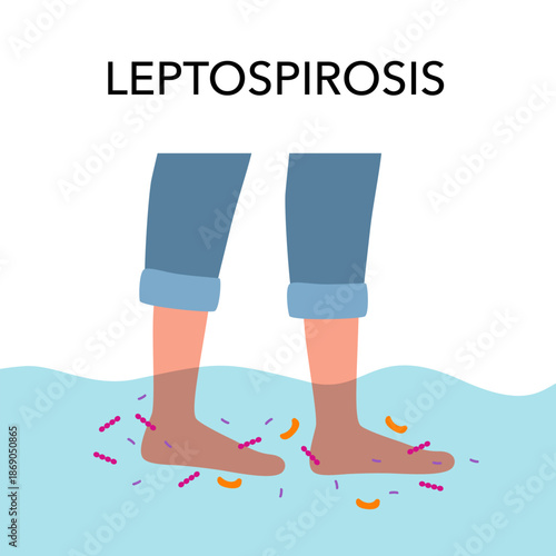 Leptospirosis infection disease from leptospira bacteria in rat urine.
