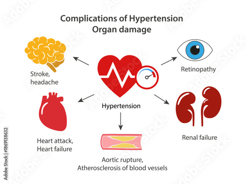 Complications of hypertension. Organ damage. Medical illustration showing target organs and possible diseases. Flat style vector illustration isolated on a white background.