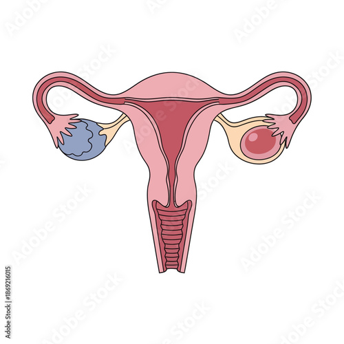 Female reproductive system anatomy illustration: uterus, fallopian tubes, ovaries