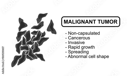 Vector Illustration of a malignant tumor. Characteristics of malignant tumors, cancer cells, invasive. Flat Illustration for medical diagrma, design element, poster, or education.	