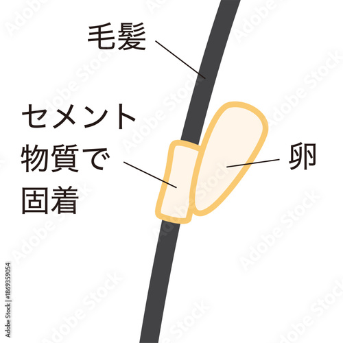 アタマジラミの卵