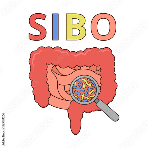 SIBO (Small Intestinal Bacterial Overgrowth) with human intestines and enlarged bacteria. Flat design symbolizing digestive disorder and bacterial overgrowth. Ideal for medical, healthcare use.