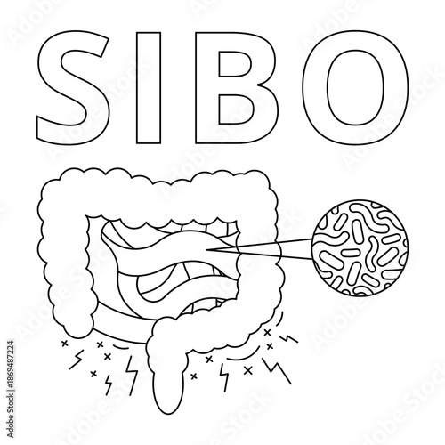 SIBO (Small Intestinal Bacterial Overgrowth) with human intestines and enlarged bacteria. Flat design symbolizing digestive disorder and bacterial overgrowth. Ideal for medical, healthcare use.