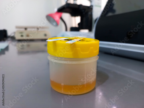 Urine sample container in medical laboratory. Yellow specimen cup on lab table, healthcare testing, clinical diagnosis, hospital equipment, medical analysis concept.
