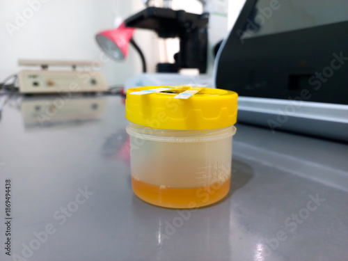 Urine sample container in medical laboratory. Yellow specimen cup on lab table, healthcare testing, clinical diagnosis, hospital equipment, medical analysis concept.