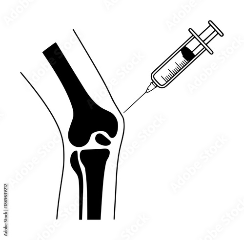 Black and white of a medical syringe injecting fluid into a human knee joint injection