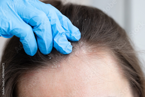 Foto An appointment with a dermatologist
