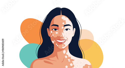 Portrait of a beautiful smiling young woman with vitiligo skin condition against a backdrop of colorful abstract shapes.