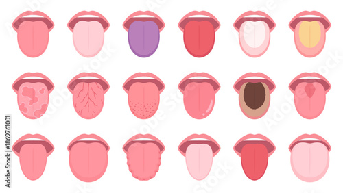 舌の状態のイラスト素材セット