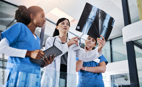 Slika na platnu Women, doctor and nurse for xray, discussion and healthcare or knee treatment in hospital