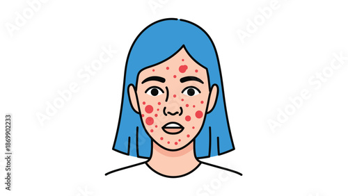Portrait of a young girl with blue hair suffering from severe acne or skin problems on her face looking concerned.