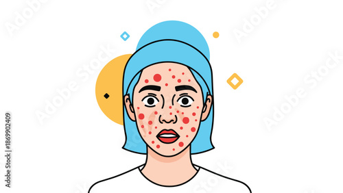 Concerned young woman with visible red acne spots or skin breakouts on her face, representing skincare struggles.