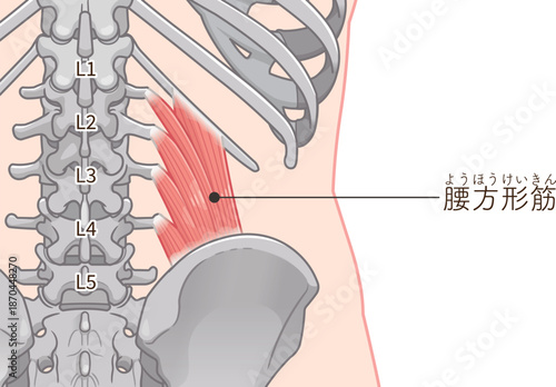 腰方形筋のイラスト、quadratus lumborum illustration