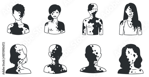 A collection of diverse human silhouettes with abstract skin patterns in black and white minimalist vector style, suitable for creative projects and representation themes
