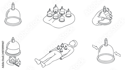 A set of cupping therapy illustrations including cups, a person receiving treatment, and application techniques in minimalist outline vector style, ideal for health and wellness projects