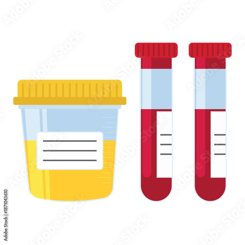 Laboratory samples of urine and blood in a glass tube on white background