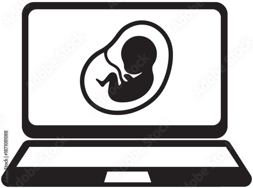 Laptop displaying ultrasound image of a fetus