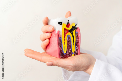 Wallpaper Mural Tooth anatomy model with caries, enamel, dentin and root canal damage in dentist hands. Concept of dental health, tooth decay, education, and medical dentistry. Torontodigital.ca