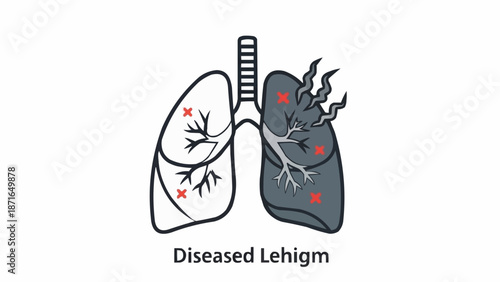 Diseased Lungs Showing Damage and Illness.