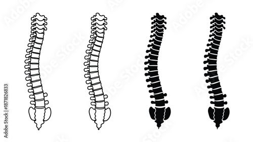 Four spinal columns showing varying degrees of curvature silhouette