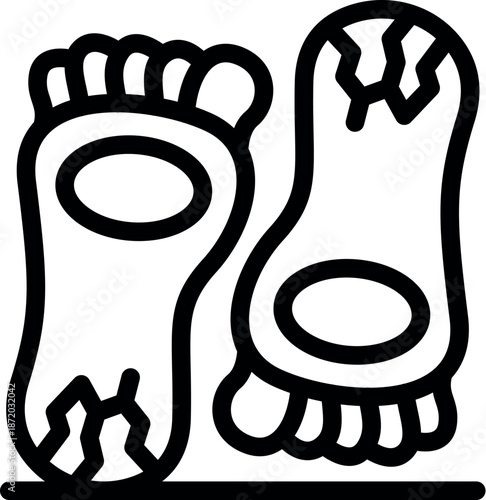 Cracked heels represent foot problems, requiring moisturizing, treatment, and care for healthy feet