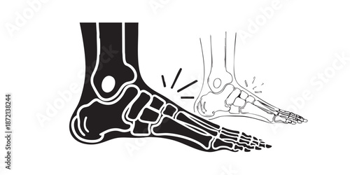 Foot Pain Anatomy Icon – Side View of Ankle Joint with Nerve Pain Signal. Medical Vector, Editable Stroke, Black Outline, Isolated on White.