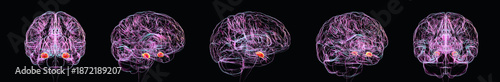 Fotografija Amygdala, 3D illustration showing the human brain in five anatomical views with the amygdala highlighted in red to visualise its location within the medial temporal lobes