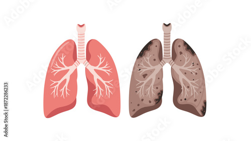 Healthy and unhealthy human lungs illustration with bronchial structure  