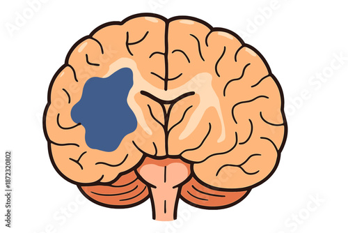 Diagram shows the human brain with highlighted area, representing function and structure in a study setting for educational purposes