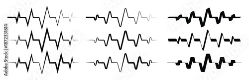 Visual representation of electrocardiogram readings showing varying heart rhythms