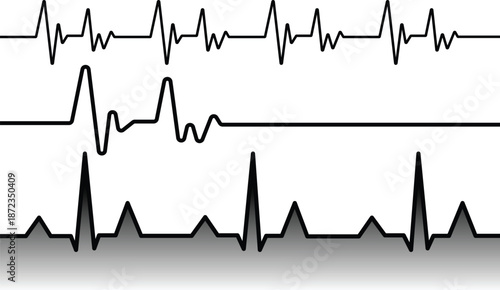 Heart rate monitor display showing electrocardiogram waveforms and vital signs data