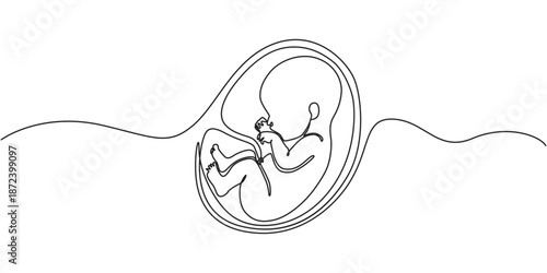Baby embryo in womb one line drawing. Cute unborn fetus baby on mother womb isolated on white background, Baby embryo in womb in one continuous line drawing. Healthy pregnancy and premature symbol