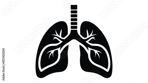 Anatomical illustration of human lungs showcasing bronchial tree and overall lung structure