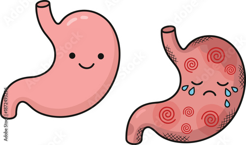 Healthy stomach illustration, unhealthy stomach comparison, digestive health diagram, medical education artwork, gastrointestinal wellness graphic, anatomy chart, flat vector illustration