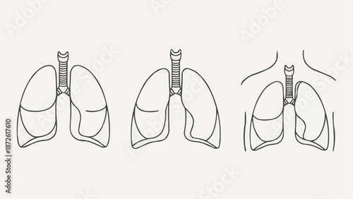 Anatomical illustration of human lungs and trachea.