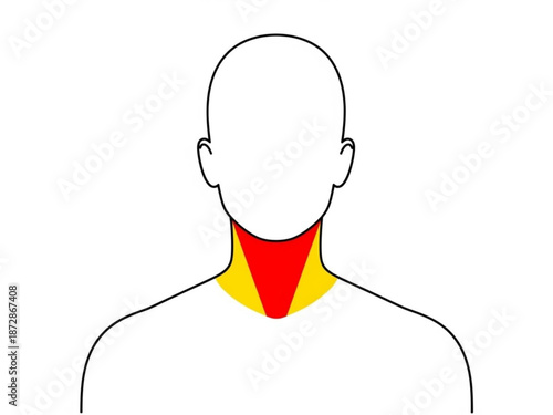 Illustration of a human silhouette with highlighted throat area in red