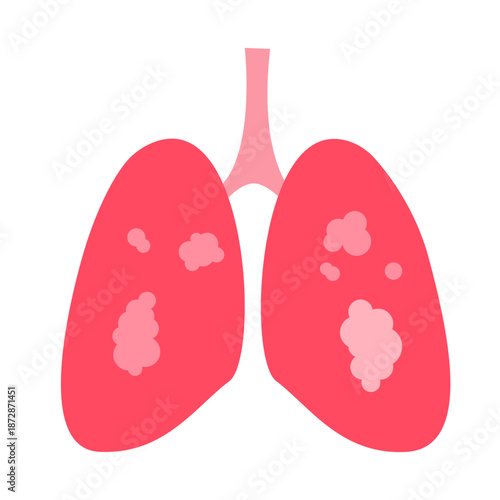 mycobacterium tuberculosis infection disease concept. TB test, medicine treatment and Drug-Resistant