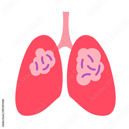 mycobacterium tuberculosis infection disease concept. TB test, medicine treatment and Drug-Resistant