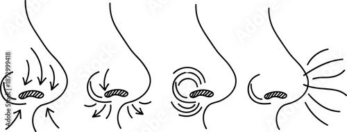 Diagram illustrating breast tissue movement and potential changes with arrows indicating direction of force.