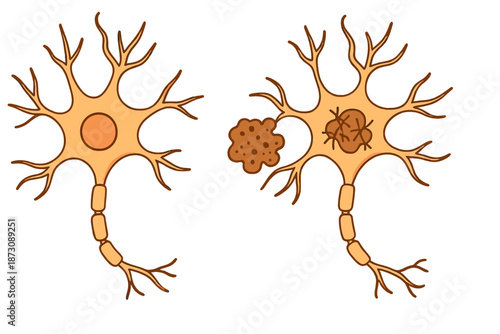 Comparison of two types of neurons showing differences in structure and connection with other cells in a scientific context