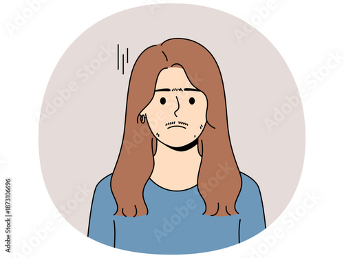 Woman suffering from hirsutism, which causes growth mustache and thick eyebrows on face, needs hormonal medications. Girl is sad because appearance of signs of hirsutism and growth of terminal hair