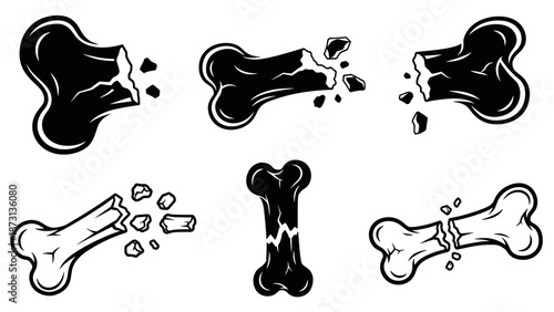 Collection of Broken Bone Illustrations in Black and White.