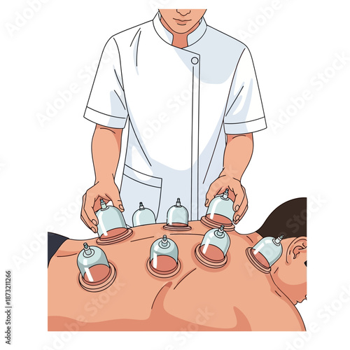Therapist applying cupping therapy on patient's back