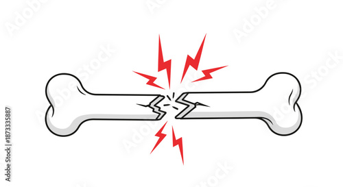 Illustration of a broken human bone with red lightning bolts indicating pain, representing a fracture, injury, or osteoporosis.