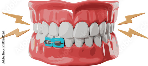 Dental Braces on Human Teeth Vector Illustration for Orthodontic Treatment, Healthcare, Stomatology, Dentist Clinic, Oral Hygiene, and Medical Health Concept