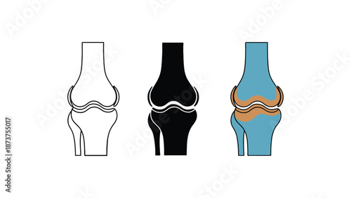 Anatomical illustrations of human knee joints in various artistic styles and colors