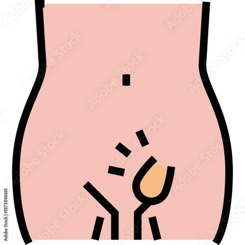 Illustration of a bump on the skin