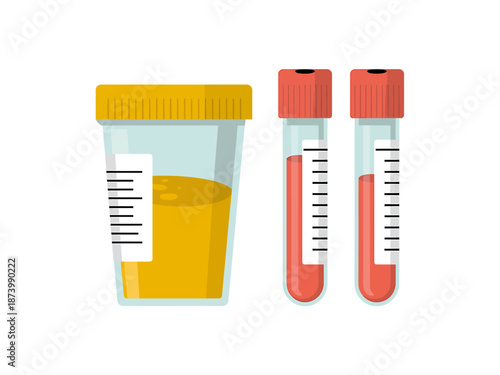Medical Lab Equipment Illustration for Diagnostic Testing