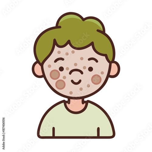 Illustration of child with chickenpox showing red spots on face and upper body, characteristic sign of childhood illness. Depiction of child with chickenpox aids medical information.