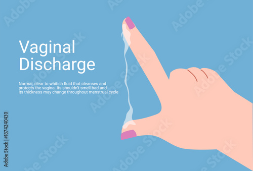 Vaginal discharge symptoms, medical concept of yeast infection, bacterial vaginosis and female reproductive health. Abnormal discharge vector illustration